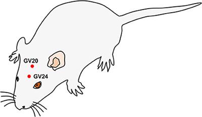 Electroacupuncture of Baihui and Shenting ameliorates cognitive deficits via Pten/Akt pathway in a rat cerebral ischemia injury model